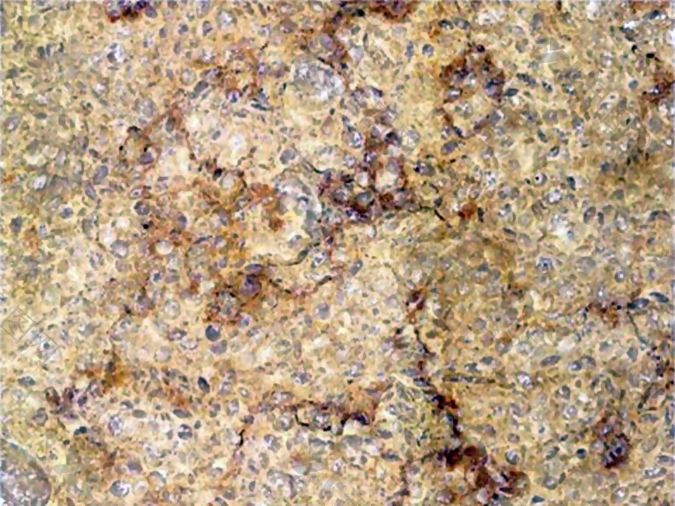 黄麻大理石瓷砖石材