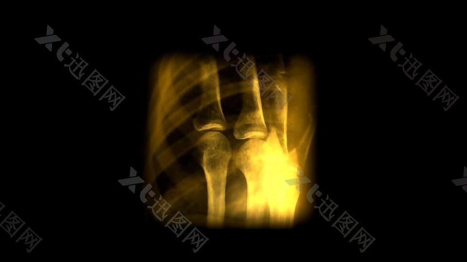 X光人体扫描屏幕界面视频素材