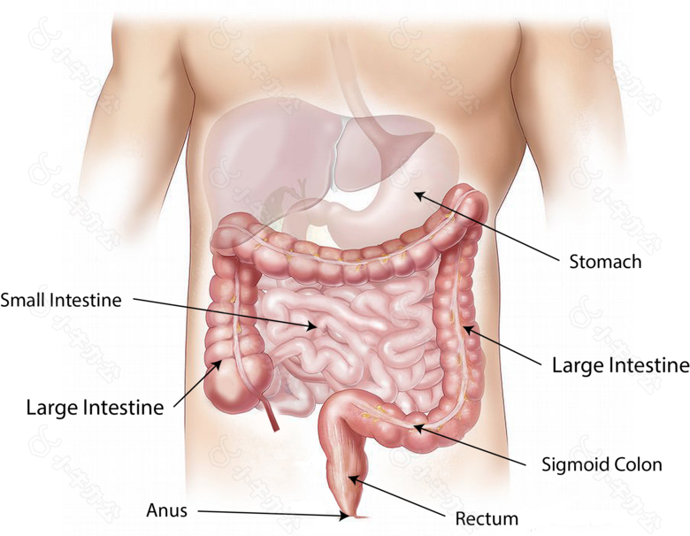 腹部,肠癌,大