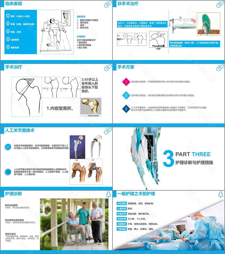 医学护理中国风股骨颈骨折护理查房课件PPT课件no.3