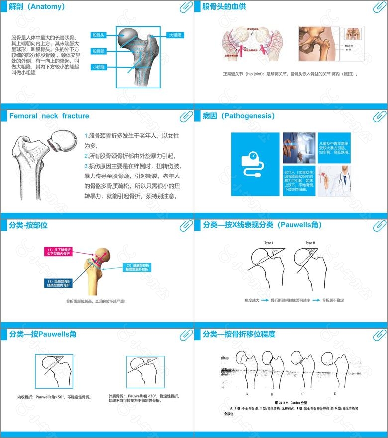 医学护理中国风股骨颈骨折护理查房课件PPT课件no.2