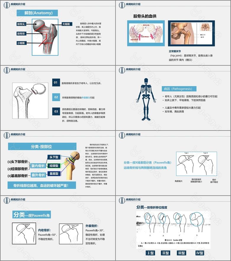医学护理炫酷风医学股骨颈骨折护理查房PPTno.2