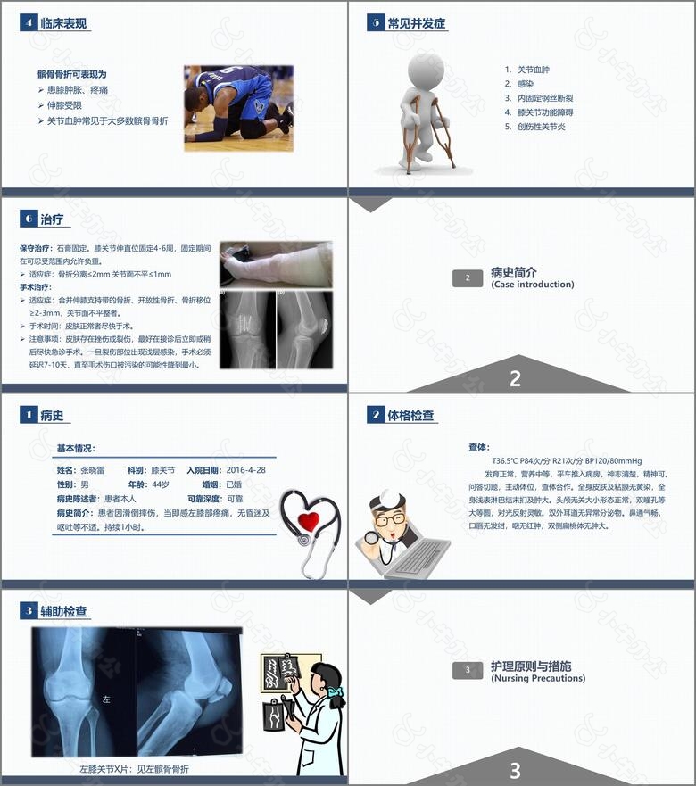 医学护理炫酷风髌骨骨折的护理查房课件no.2