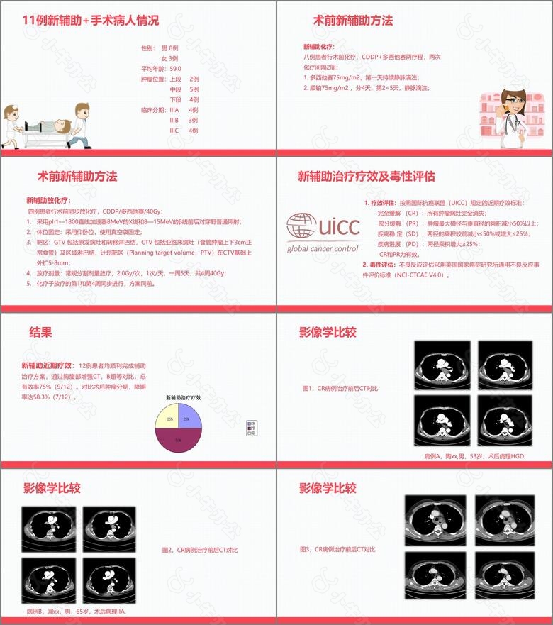 局部晚期食管癌新辅助治疗no.3