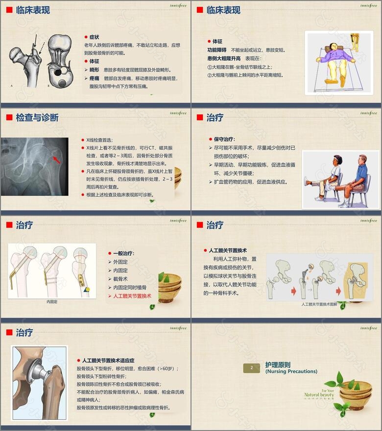 股骨颈骨折患者的护理查房no.2