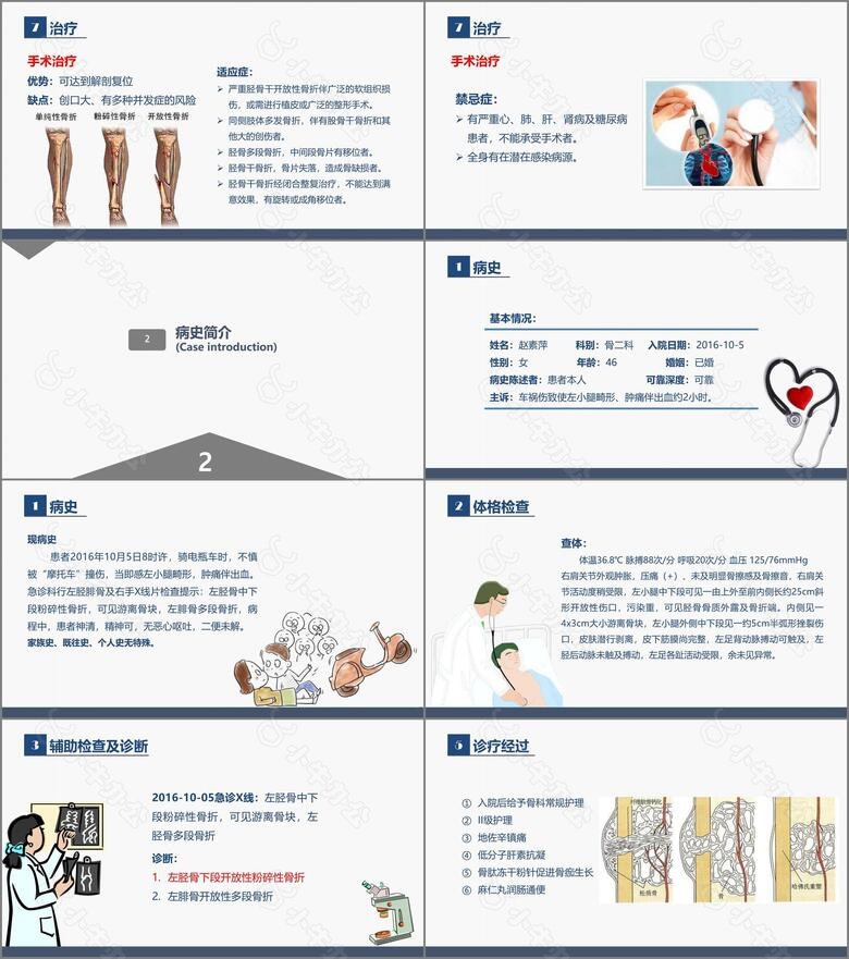 骨科胫腓骨骨折教育查房no.3