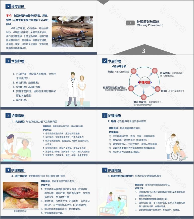 骨科胫腓骨骨折教育查房no.4