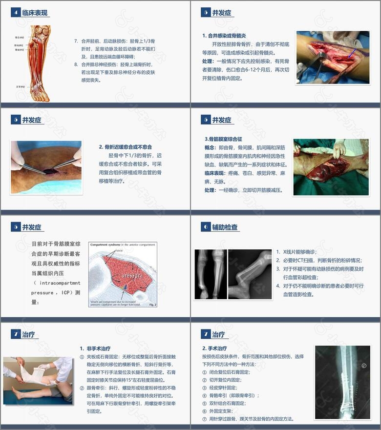 骨科胫腓骨骨折教育查房no.2